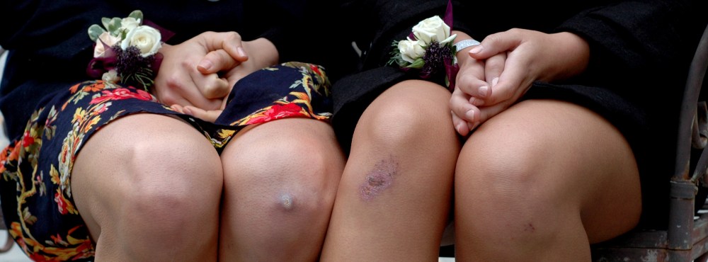 last of the wedding -girls